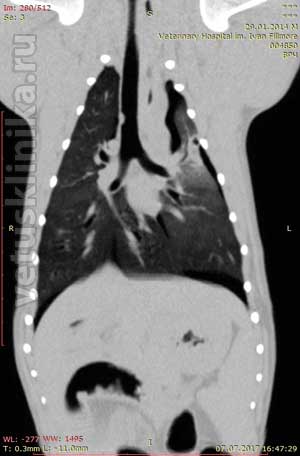 КТ scan травма краниальной доли левого лёгкого