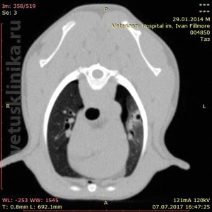 КТ scan травмированная ребром краниальная доля левого лёгкого, незначительный пневмоторакс