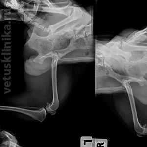 Перелом левой подвздошной кости и левой вертлужной впадины Rtg m/l